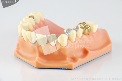 Image of Dental model (with different treatments)