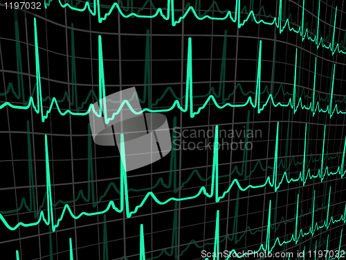 Image of Heartbeat on a black monitor. EPS 8