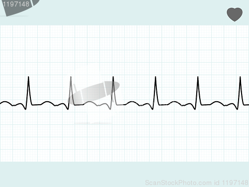 Image of Normal electrocardiogram ECG. EPS 8