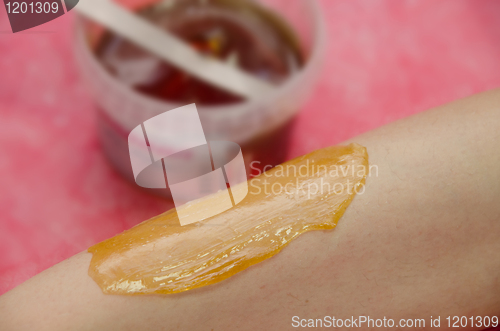 Image of sugaring epilation