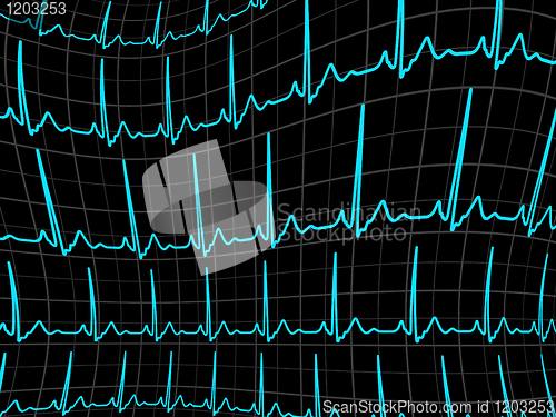 Image of ECG tracing monitor. EPS 8