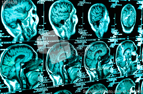 Image of Ct scan of the human brain tile