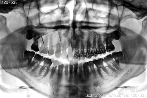 Image of dental scan x-ray