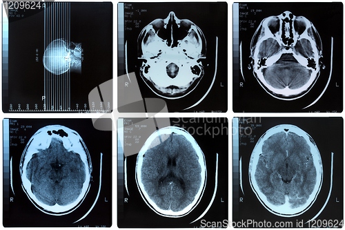 Image of Medical Xray