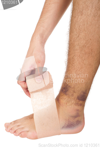 Image of Bandaging a sprained ankle