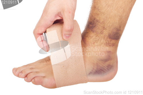 Image of Bandaging a sprained ankle