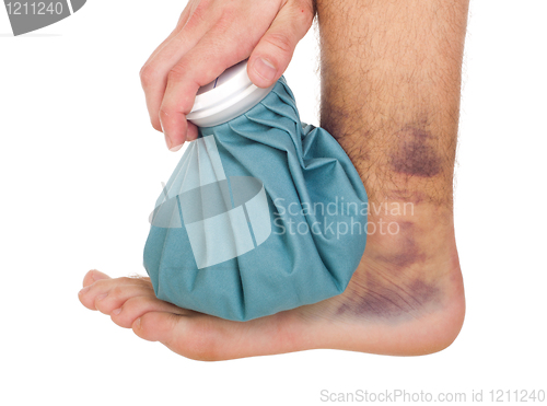 Image of Icing a sprained ankle