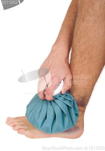 Image of Icing a sprained ankle