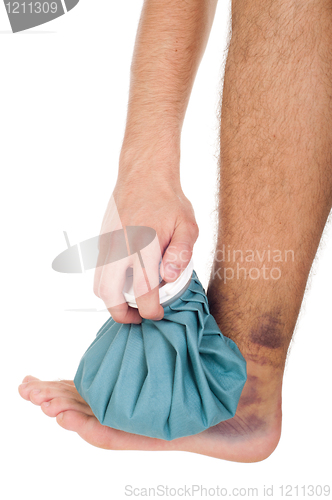 Image of Icing a sprained ankle