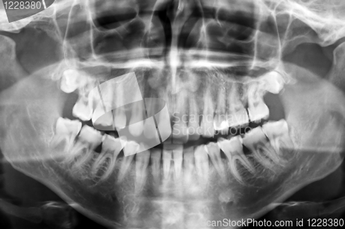 Image of dental scan