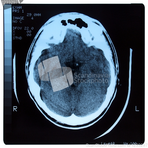 Image of Medical Xray