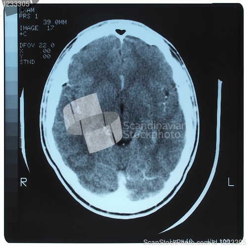 Image of Medical Xray