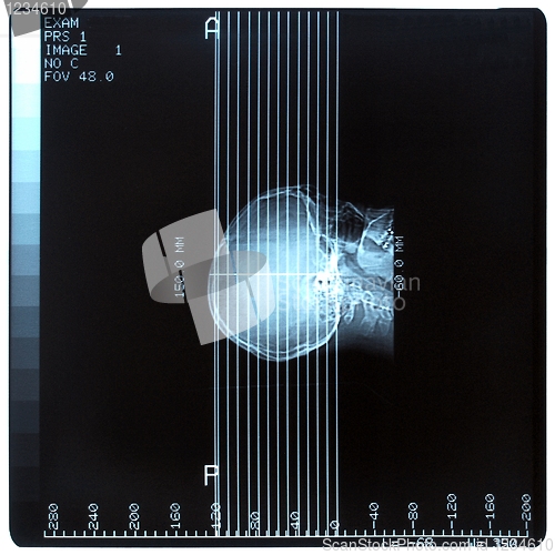 Image of Medical Xray