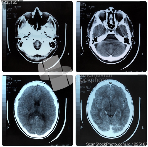 Image of Medical Xray