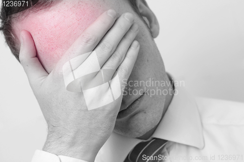 Image of Headache