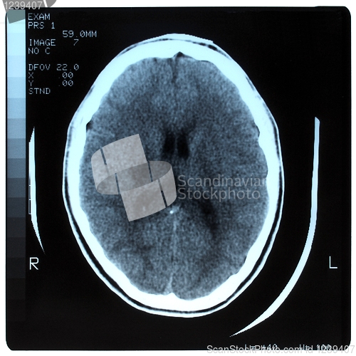 Image of Medical Xray