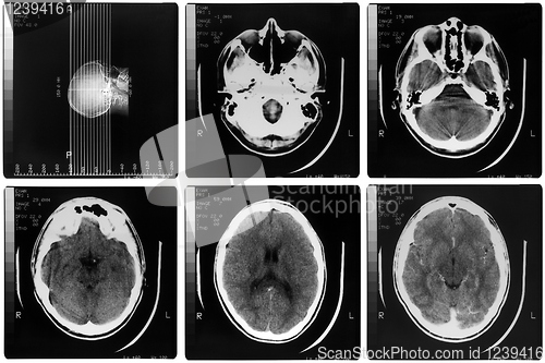 Image of Medical Xray
