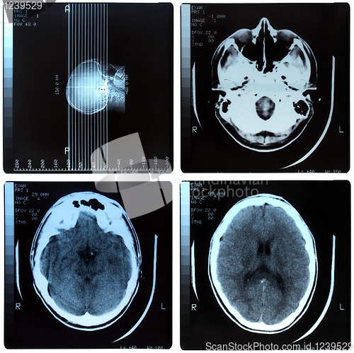 Image of Medical Xray