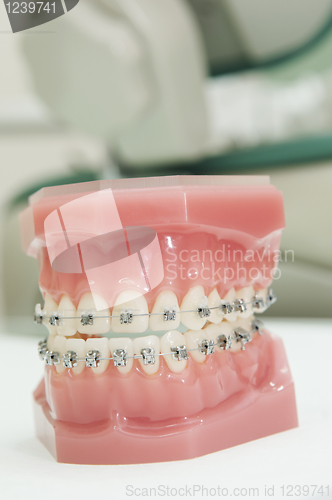 Image of lower and upper dental jaw braces model