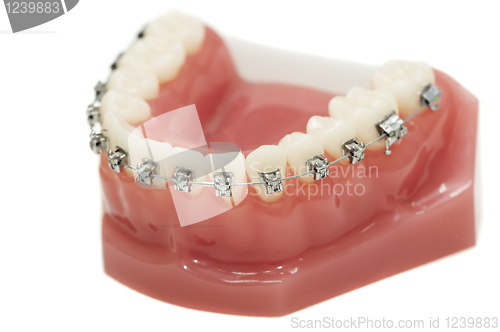 Image of lower dental jaw bracket braces model isolated
