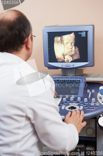 Image of ultrasound medical doctor