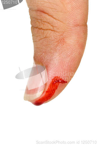 Image of Bleeding thumb finger
