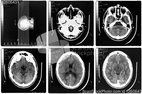Image of Medical Xray