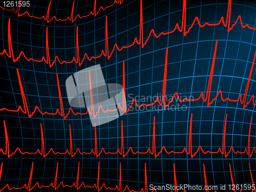 Image of ECG tracing monitor. EPS 8