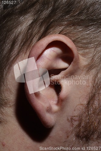 Image of Ear