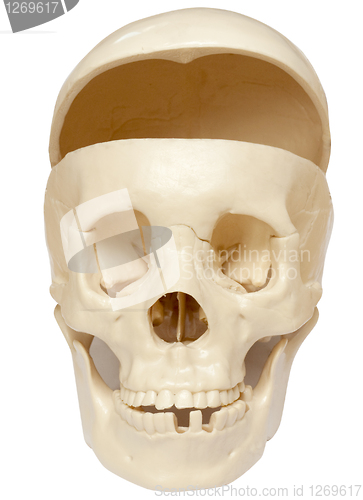 Image of Open skull