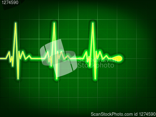 Image of Heart cardiogram on it deep green. EPS 8