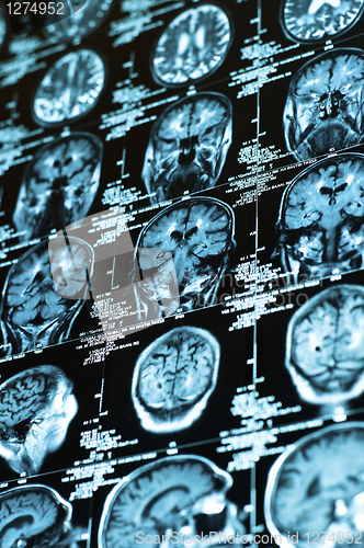 Image of Ct scan of the human brain tile