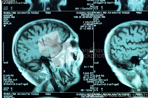 Image of Ct scan of the human brain tile