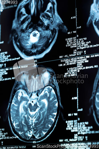 Image of Ct scan of the human brain tile