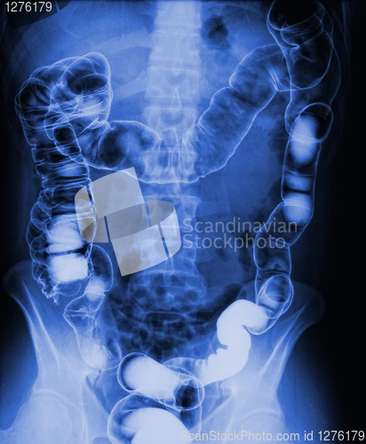 Image of torso xray