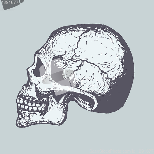 Image of Human Skull