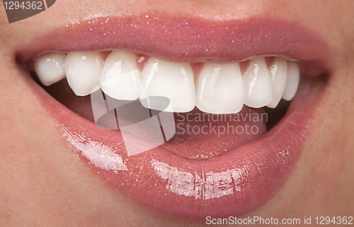 Image of Teeth