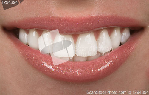 Image of Teeth