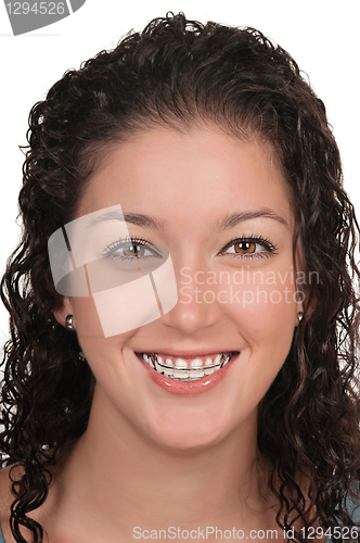 Image of Cosmetic Braces