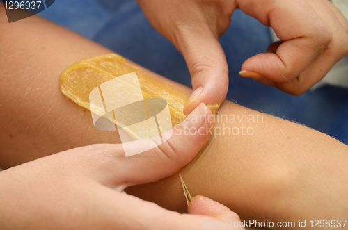 Image of sugaring epilation