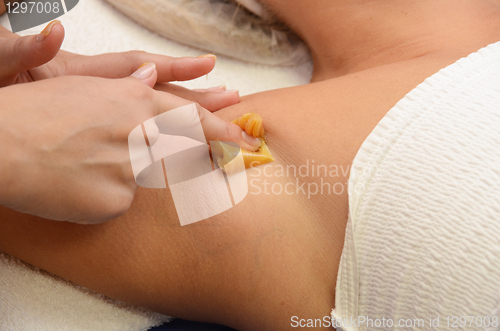 Image of sugaring epilation