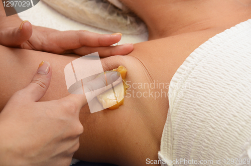 Image of sugaring epilation