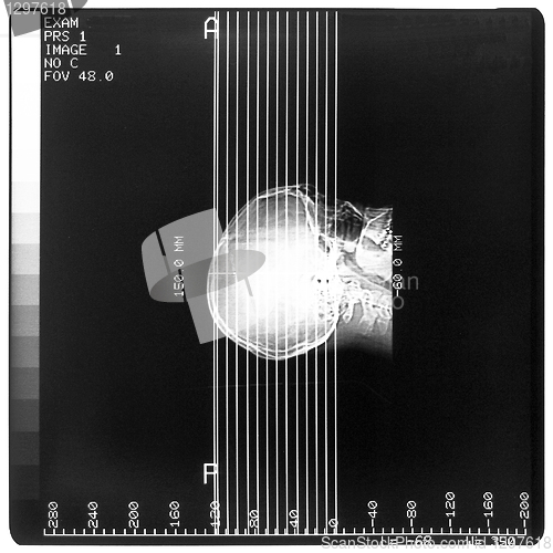 Image of Medical Xray