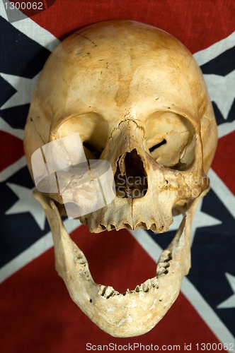Image of Confederate skull