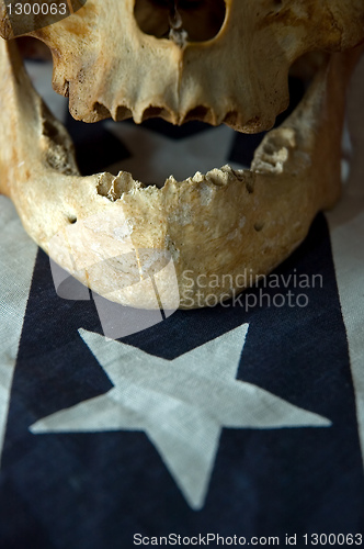 Image of american skull