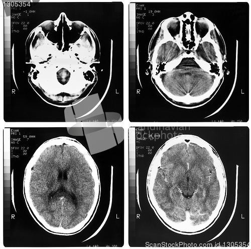Image of Medical Xray