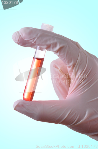 Image of Blood Sample