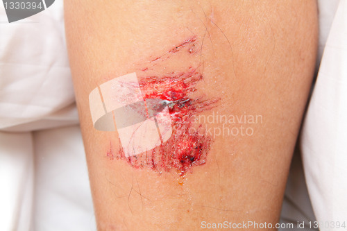 Image of wound