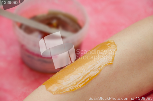 Image of sugaring epilation