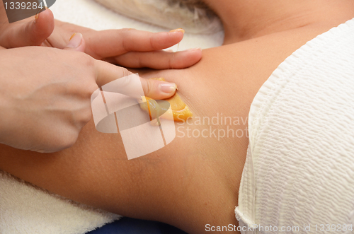 Image of sugaring epilation